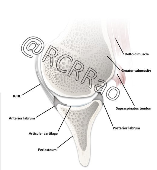 Working on a diagram for a review of Bankart lesions
#MSK #Medicalillustration #FOAMed #FOAMrad #MedEd