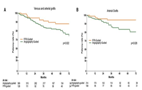 CircIntv's tweet image. Traveling to #SCAI2019 Here is May’s reading material from circinterventions.ahajournal.org during travels ➡️Rotational Atherectomy, Adverse Outcomes after Mitral Valve Repair, IFR/iFR discordance, #FFR guided #SVG implantation @HeartNews @American_Heart @CircAHA @CircOutcomes @SCAI