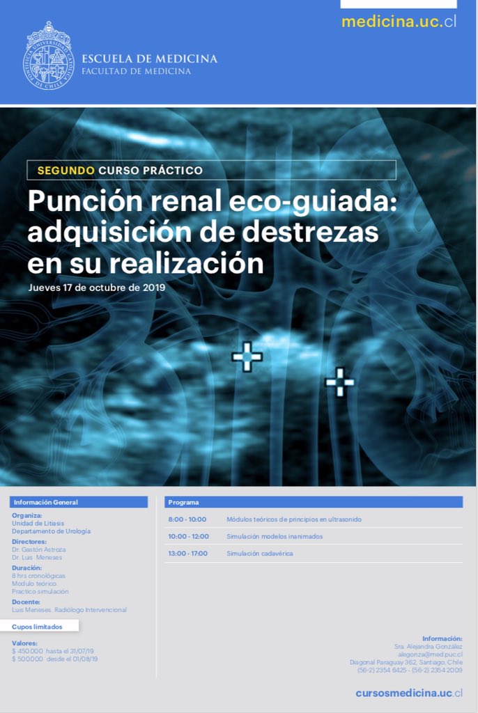 Segunda versión <a href="/DRSALVADOSTONE/">Jose Antonio Salvadó</a> <a href="/idsaez/">ivan saez valenzuela</a> <a href="/FelipePauchard/">Felipe Pauchard</a> <a href="/filialendouro/">Filial de Endourología Chile - SCHU</a> <a href="/adsilvaw/">Andres Silva</a>