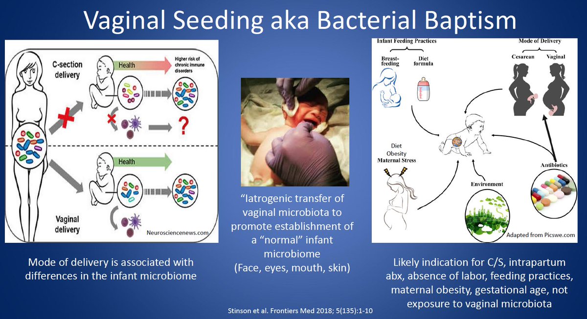 dyupharmd's tweet photo. Dr. Latania Logan on vaginal seeding - "I've been crying on the inside since I learned about it." (Loving this presentation -- she has the best comments!) #PIDSASP19 @PIDSociety @SIDPharm https://t.co/CA9UqWFtyu