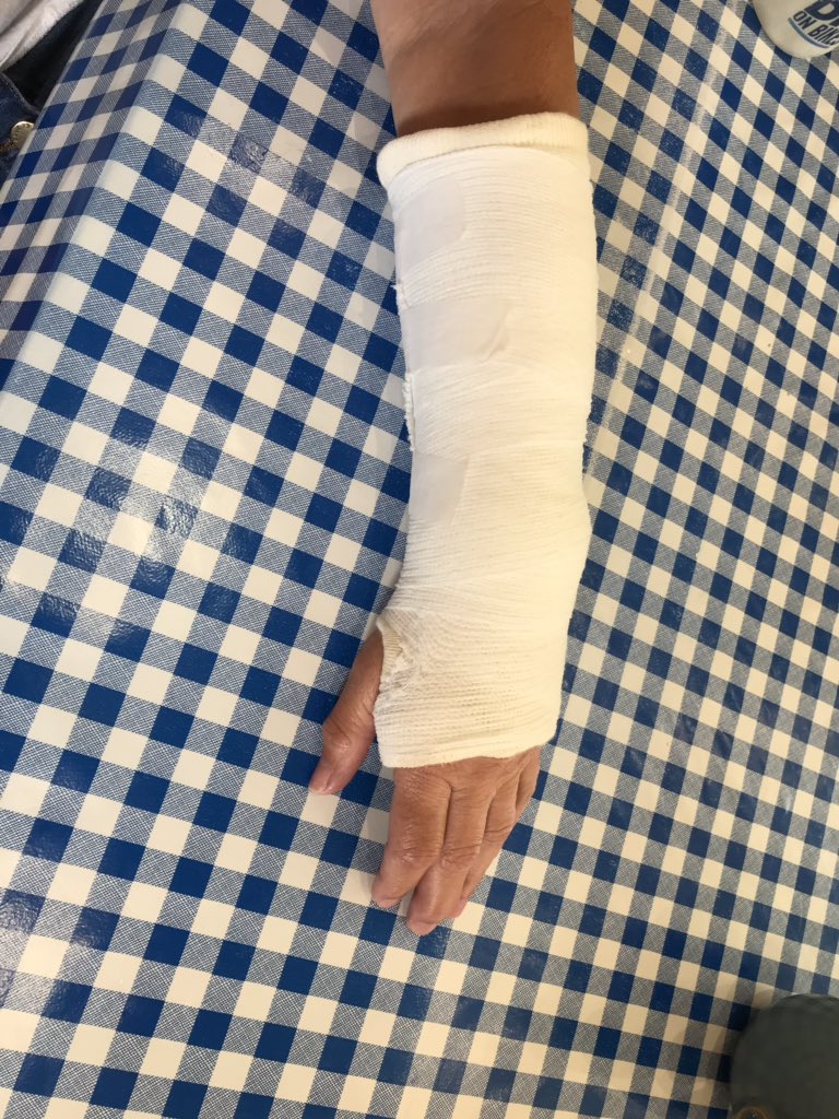 This wasn’t in my plan! Gutted to have to withdraw from #MNTC Track Championship in just four weeks! Yes it was a cycling accident, not my fault! Hope to be back to training next week! Send me all your healing vibes please.