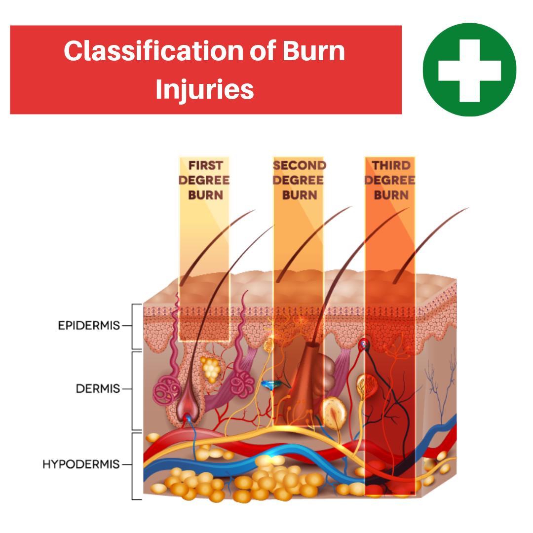 firstaidadvice's tweet photo. 🔥 🔥 🔥 

#burns #burninjuries #burnawareness #burn #firstaidquiz #wilderness #firstaid #firstaidfacts #firstaidCPD #CPR #firstaid #CPRinstructors #CPRtraining #CPRcertified #CPRclass #CPRcertification #AED #CPRinstructor #CPRtrainer #heartstart #burninjury https://t.co/H0whDVaGtD