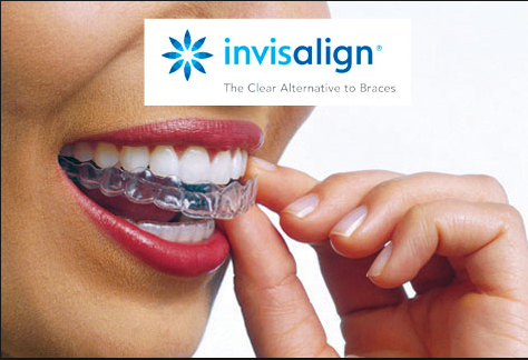 LS1Dental's tweet photo. FREE DAY Friday ! Free  consultations for Invisalign ® an effective &amp; discrete removable orthodontic (Brace system)  for the smile you have always wanted, why wait call the team today 0113 278 6623
#Leeds #Headingley #invisalign #smilesbetter
https://t.co/SUljXxiXs8 https://t.co/Jzv86TCRjl