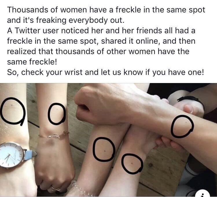 I have one there too 😐 anyone else?! #birthmark #womensfreckle #yegmoms https://t.co/XN3Qr7mqcg