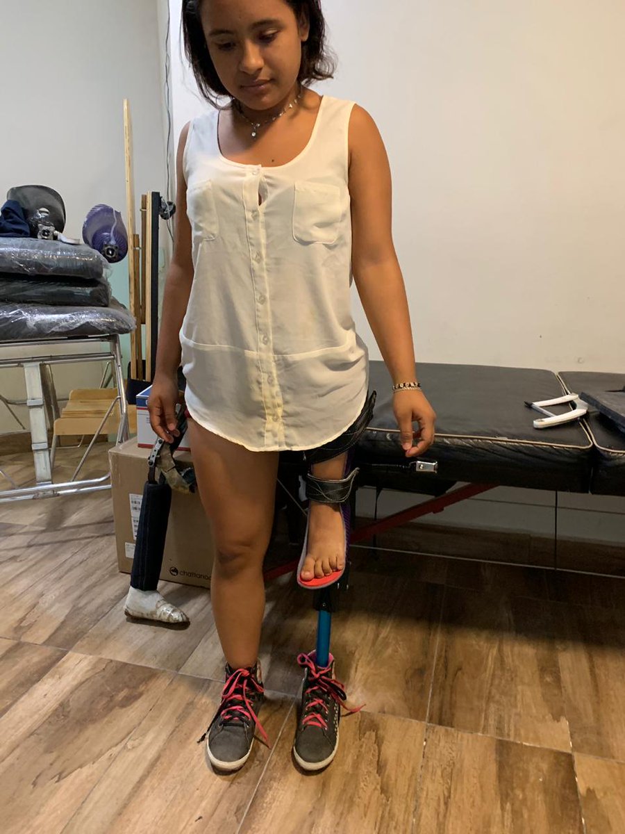 Vecsi was born with a left leg deformity, her leg didn’t fully develop, and she has her foot where her knee should be. She is excited about her new LIMBS prosthetic because now she will be able to focus on her studies. Thank you to the students at <a href="/AISVienna/">AIS Vienna</a> helping Vecsi!