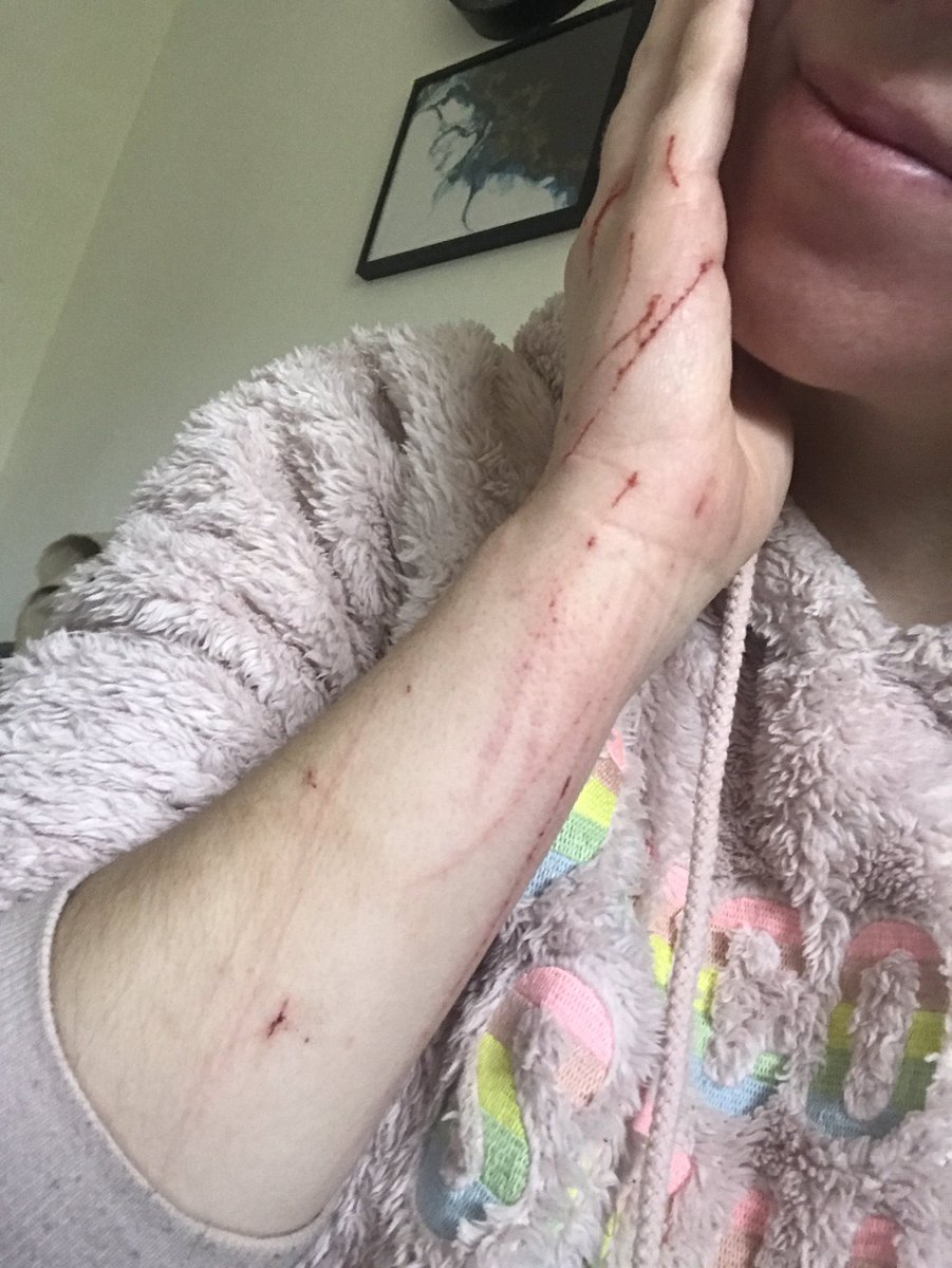 Lea Twitterren Thread Syndrome Du Tigre J Ai Adopte Y A 3 Ans Un Chat Qu On Peut Qualifier D Agressif Je Decide De Partager Ma Petite Histoire Ici Parce Que Je Vois Beaucoup De Lea Twitterren Thread Syndrome Du Tigre J Ai Adopte Y A 3 Ans Un Chat Qu On Peut Qualifier D Agressif Je Decide De Partager Ma Petite Histoire Ici Parce Que Je Vois Beaucoup De