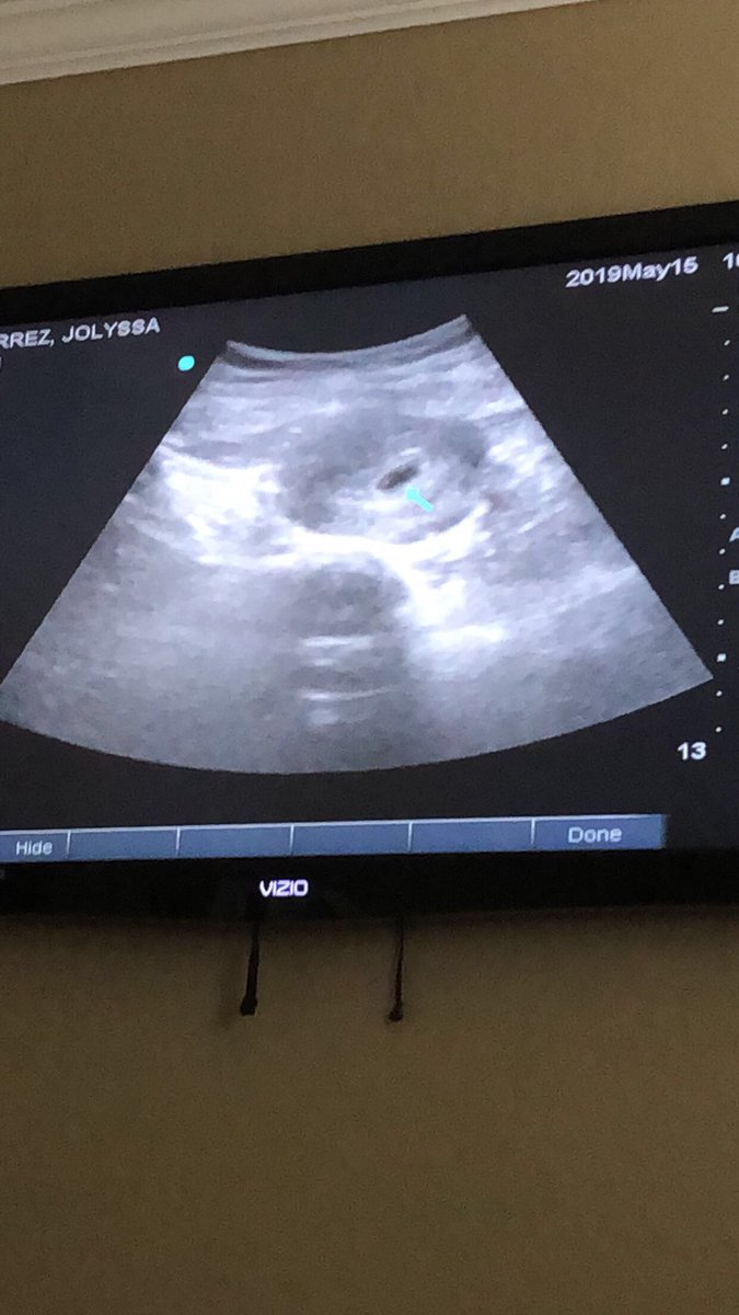 pomar_mario's tweet photo. Baby Pomar on the way and Jeremiah is excited❤️ https://t.co/8UrrDzEWKY