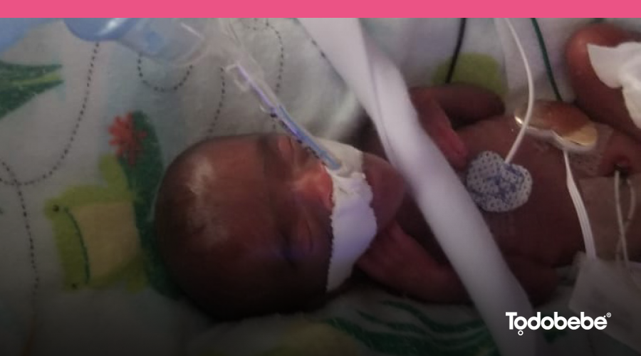 Todobebe's tweet photo. Esta pequeña y gran luchadora nos muestra que todo es posible. Al nacer, pesaba 245 gramos. 😍 https://t.co/DjmtTMOWAl https://t.co/3BsiXiy7mS