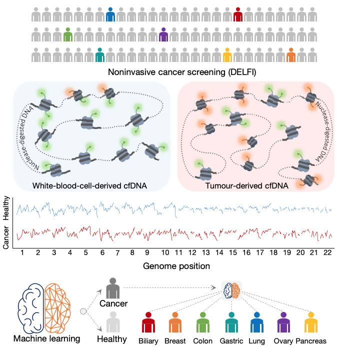 tdazad's tweet photo. Progress towards pan-cancer #LiquidBiopsy via genome-wide fragmentation patterns of cell-free DNA from @leal_md_sp @velculescu @hopkinskimmel in @nature https://t.co/qkXWvoCB2z