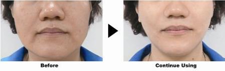 BraphyMask's tweet image. Polaroisin -- V Shape Facial Mask - mailchi.mp/4e1c288188e7/p…