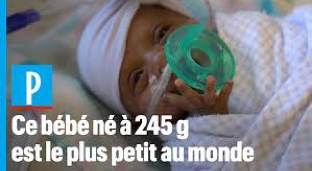 Mediacongo Net V Twitter Californie Le Plus Petit Bebe Ne En Vie Au Monde Quitte L Hopital Apres Cinq Mois De Soins T Co Jzgmdqt26q France Info T Co Rqng0hmcnk