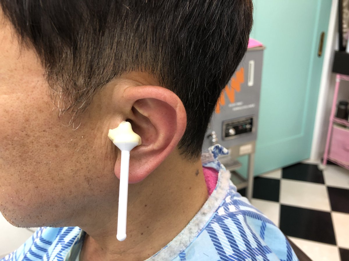 耳毛脱毛 耳毛脱毛