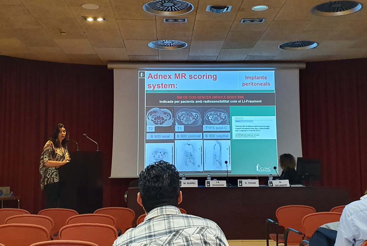 La dra Maica Sebastià @LaSebastia ens explica els criteris Adnex de RM en masses ovàriques en el #CongresCatalaRadiologia19