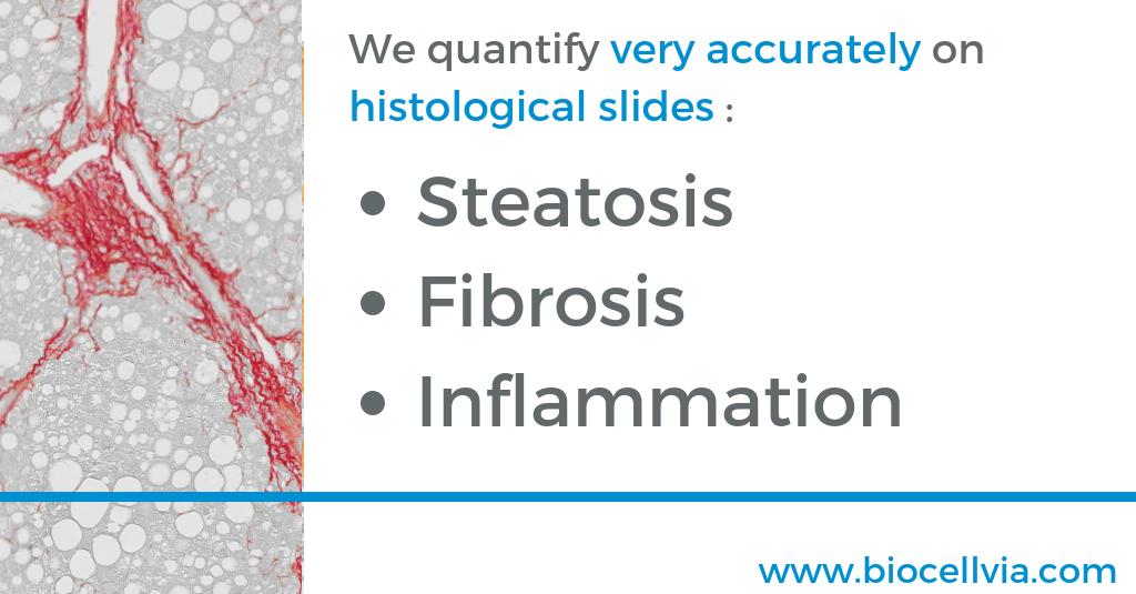 We are doing a NASH quantitative analysis by quantifying with considerable accuracy the three key parameters of this pathology: steatosis, fibrosis and inflammation. 
More info on : biocellvia.com
#EASL #AASLD #ILC2019 #NASH #NAFLD #steatosis #fibrosis #inflammation