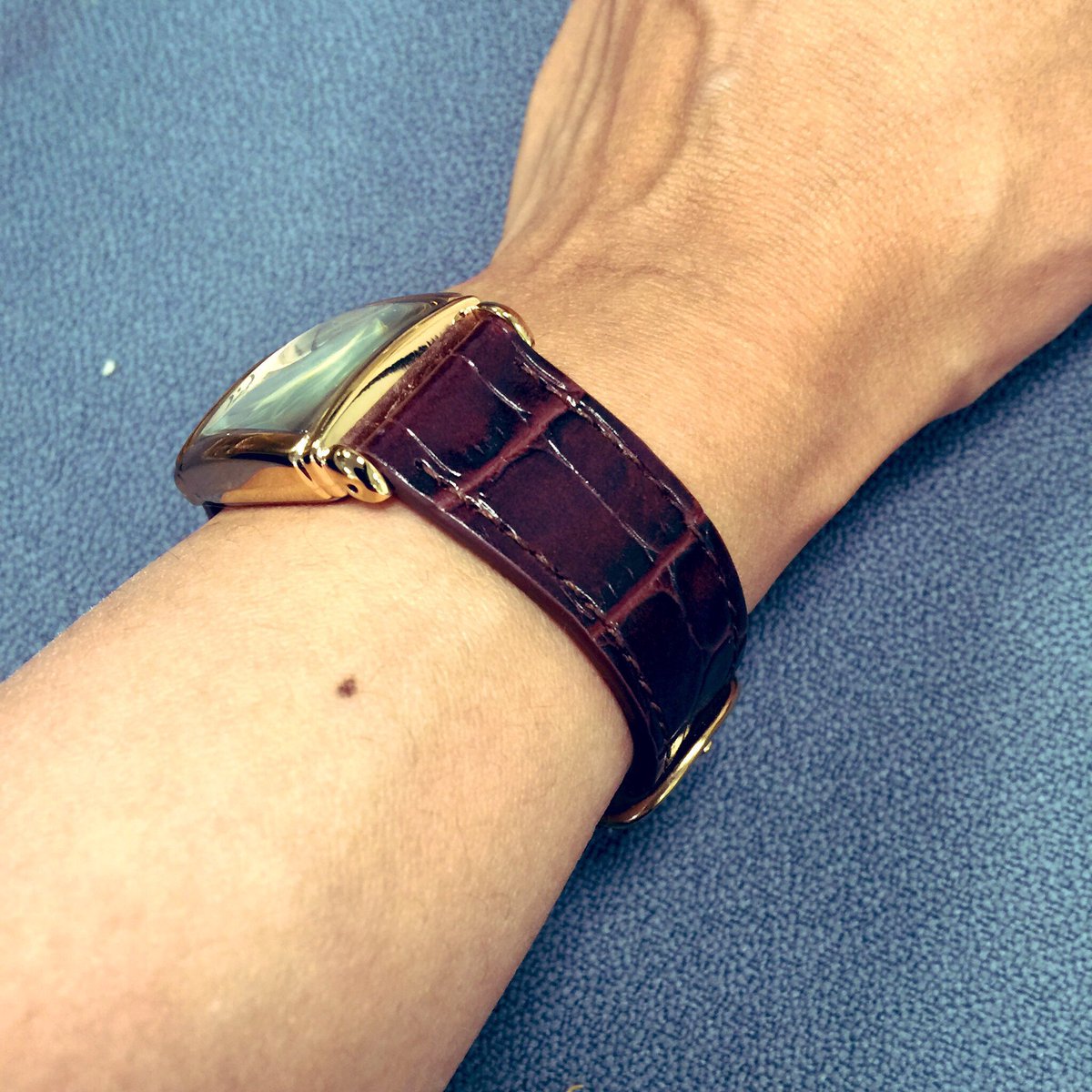 gitajoshi's tweet image. This #wristfreckle thing ...