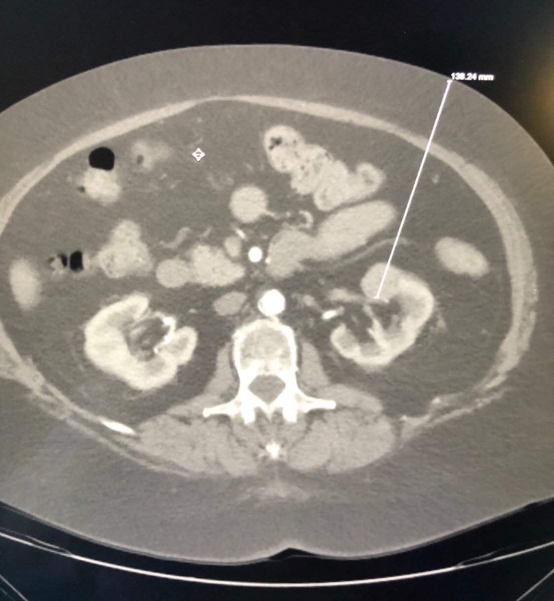 Justin Stenz, MD tweet media