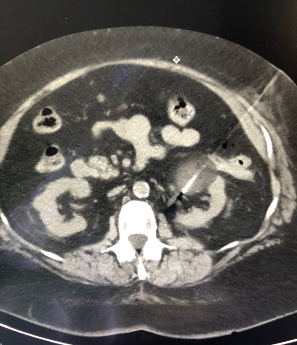 Justin Stenz, MD tweet media