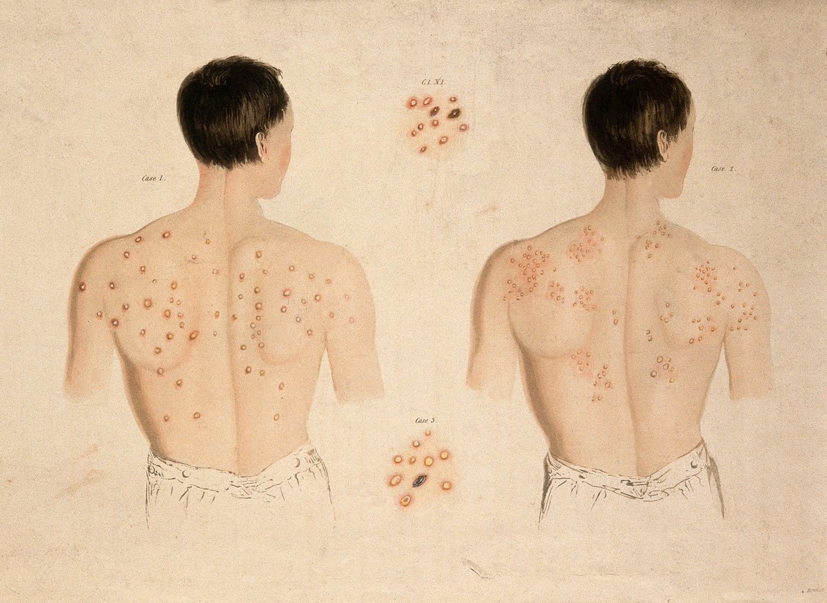 Pathologyevent tweet picture