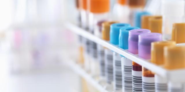 MedDiscCat's tweet image. Gain a better understanding of the routes to sourcing biosamples ow.ly/565j30oM9kz

#biosamples #dataAccess #article #MondayMotivation