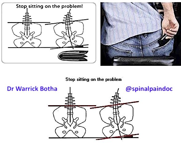 warrickbotha's tweet photo. For more Lower Back Pain and Pelvic Tilt info, visit:

https://t.co/FiCzM5Wllc

#neckpain #backpainrelief #lowbackpain #soreback #backache #healthyspine #headache #nervepain #sciatica #slippeddisc #posturecorrection #goodposture #chiropractor #chiro #painrelief #spinalpaindoc https://t.co/YhAHquBX2m