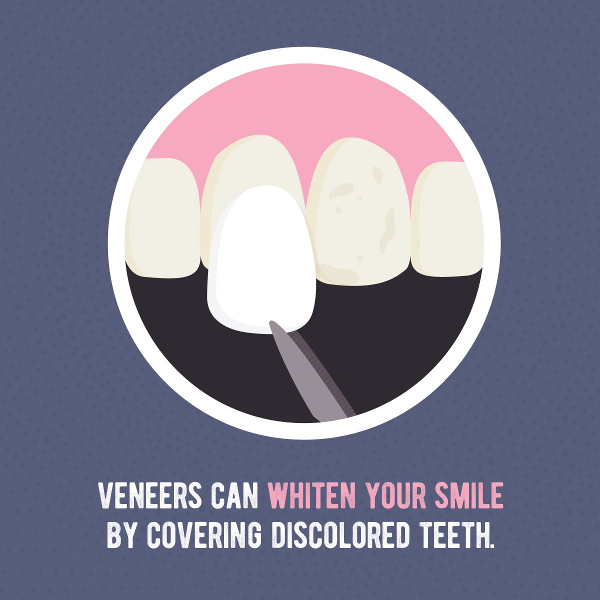 iTooth Dentistry (@itoothdentistry) / Posts / X
