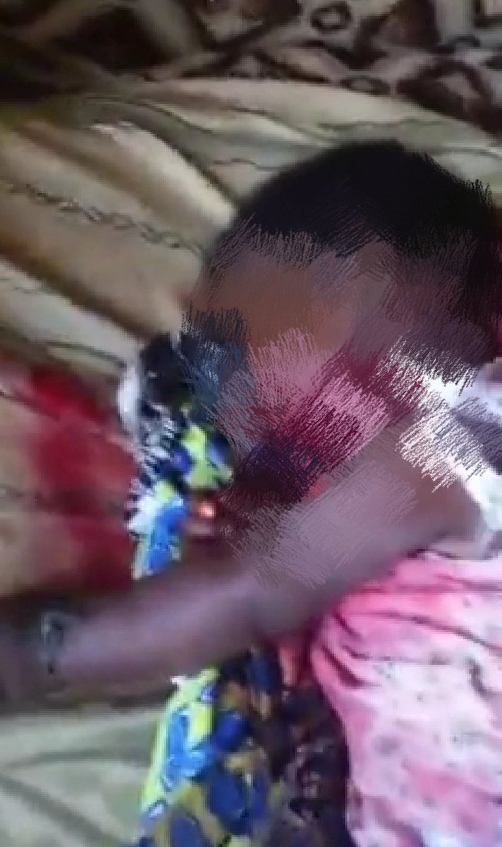 MimiMefoInfo's tweet photo. "They forced their way into the house...shot my baby who was sleeping while I was in the kitchen..The  military did that..I place a curse on them for doing this to my child...these tears I shed will never go in vain.."
Mother of the 4-month old baby shot in Muyuka today explains https://t.co/fQBOCLC231
