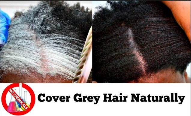 Permanent Hair Remov On Twitter Dr Greyhalt Grey Gray White Hair