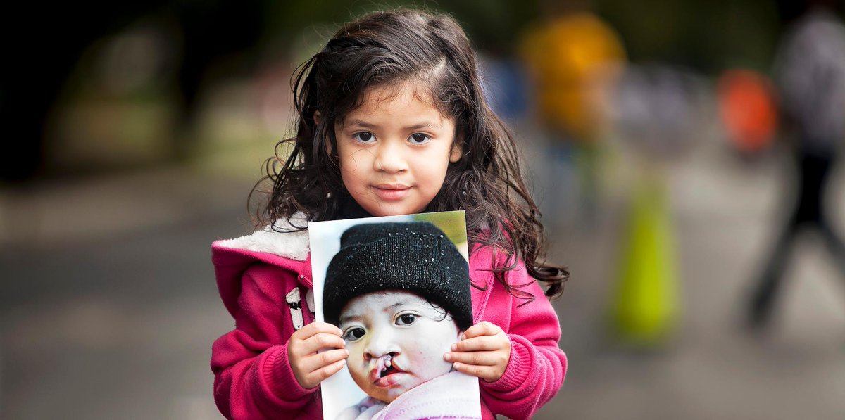 JNJNews's tweet photo. #JNJ has helped @operationsmile provide over 100,000 smiles to children worldwide. This #JNJSmileWeek, for every photo shared on @donateaphoto, J&amp;J will give $1 to to help children globally with cleft lip, cleft palate or another facial deformity. Join us: https://t.co/Y76RpNMpE3 https://t.co/QO8FcOR1xC
