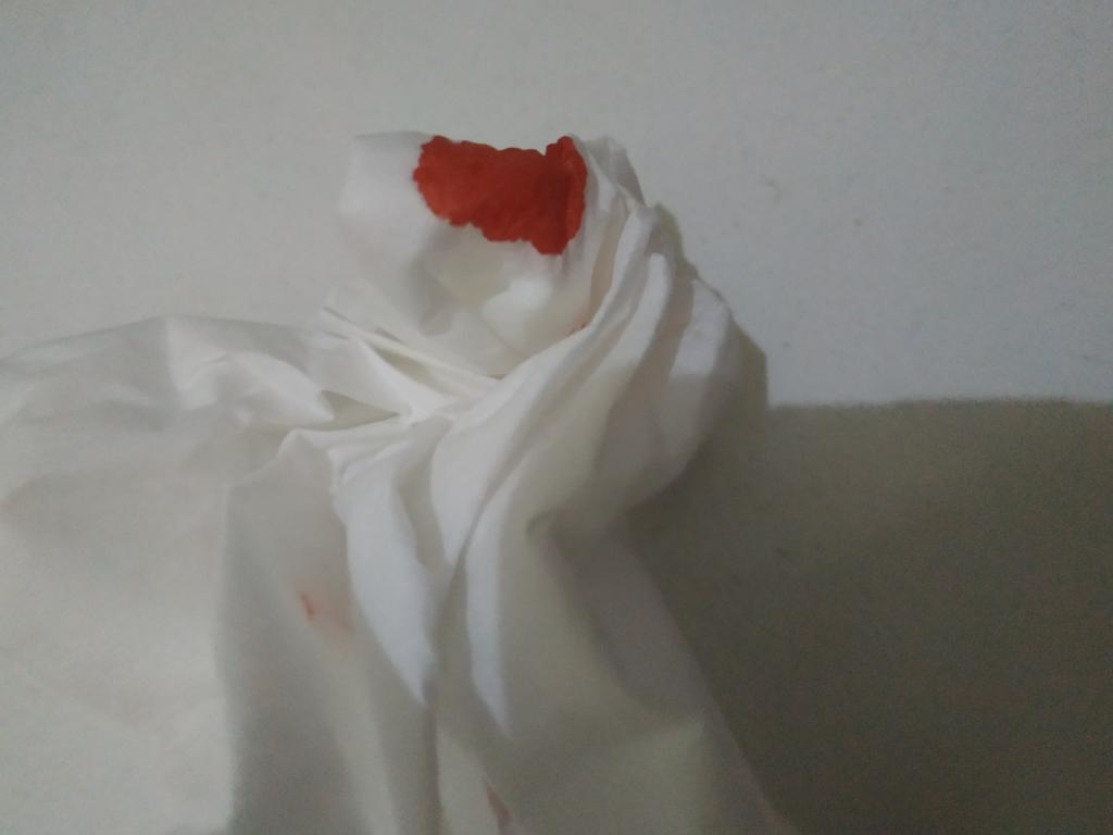 Gambar Darah Mimisan Di Tisu – cabai