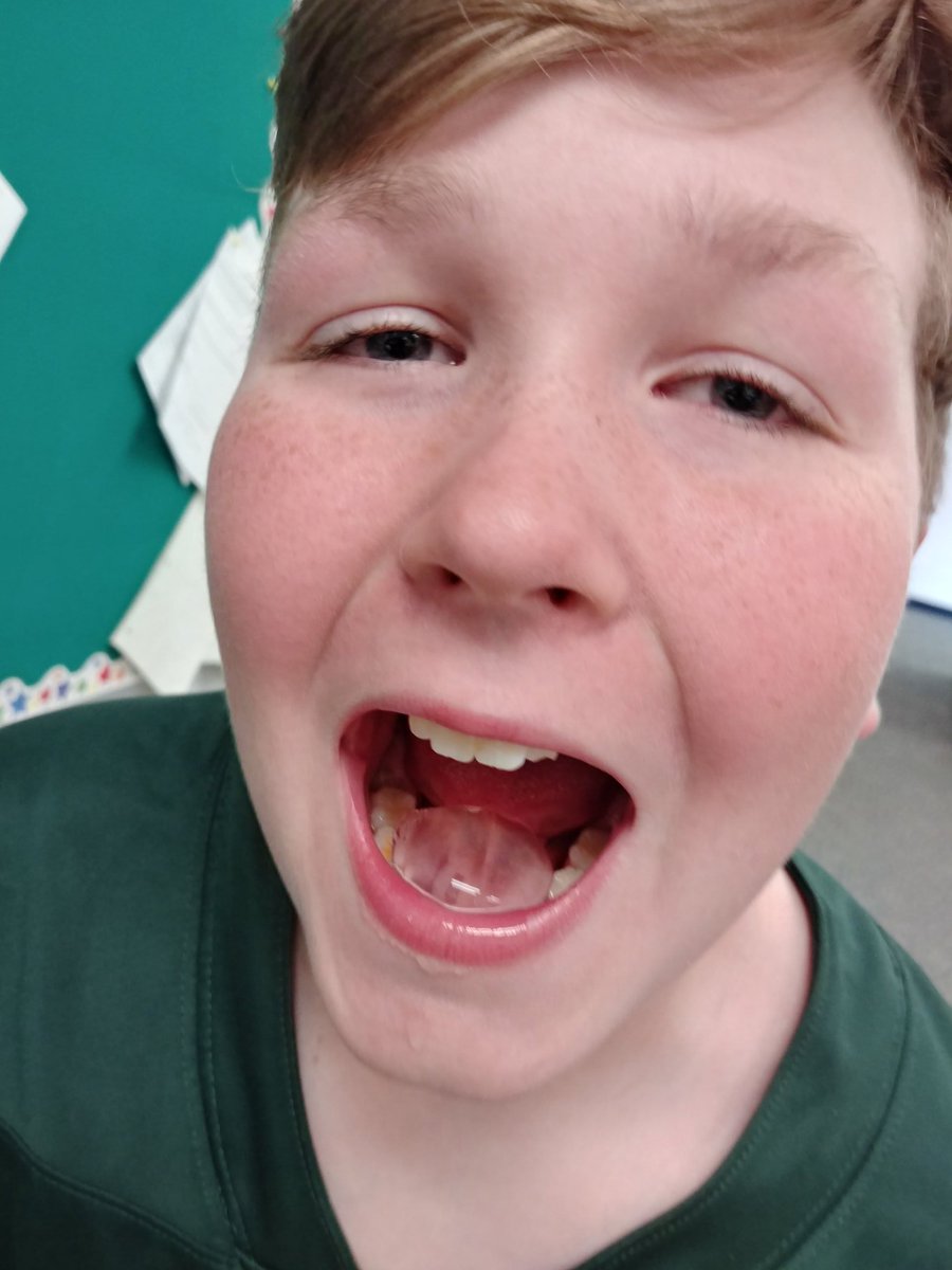 Kutchensclass's tweet photo. 6th grade Social Studies learns how to make edible water blobs in a unit designed to teach how we interact with the environment....and can cut down on our use of plastic!@Kutchensclass @Oakview_MS https://t.co/fZ9ncZdXoQ