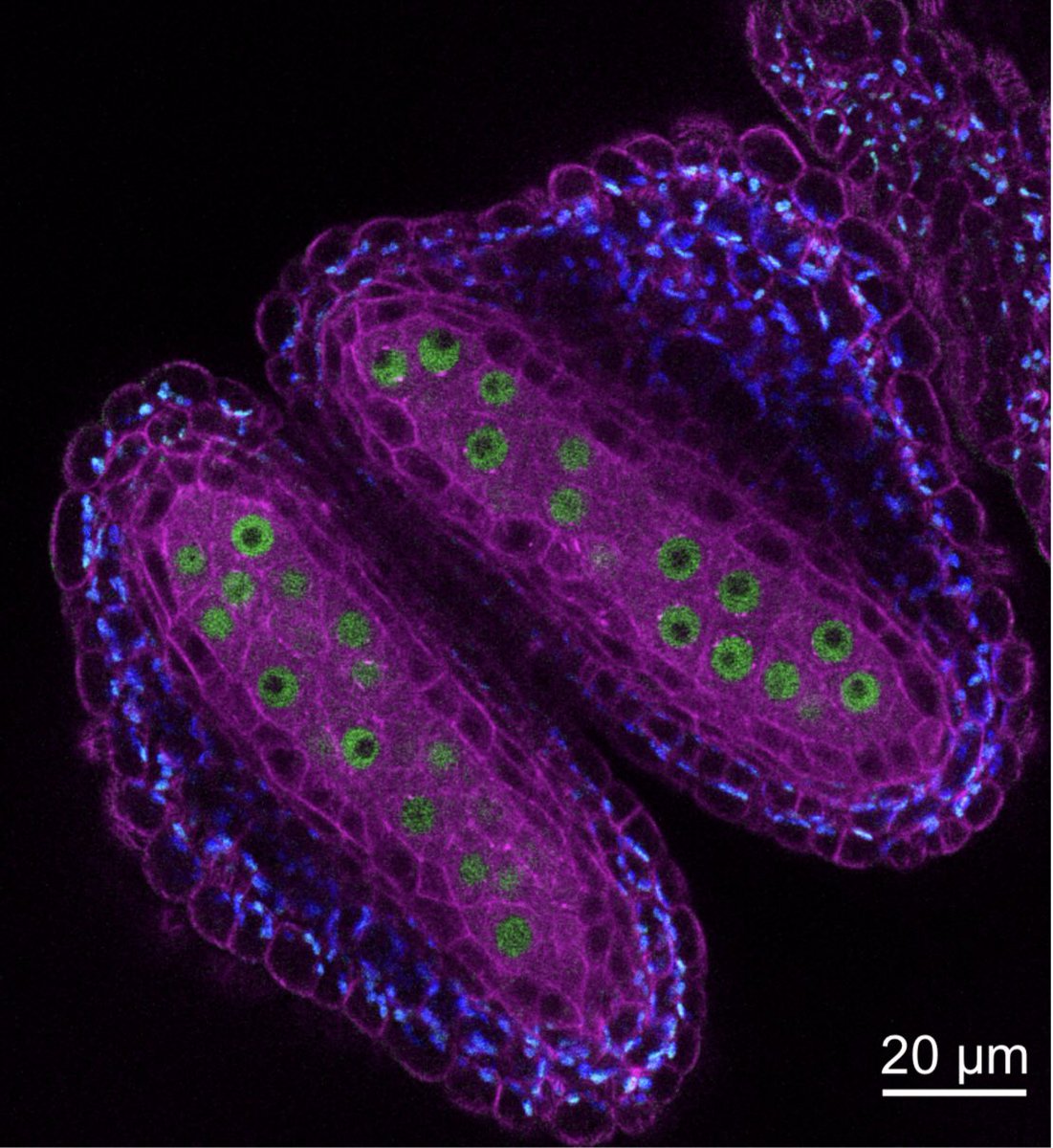 Hardtke Lab 🇨🇭 (@hardtke_lab) on Twitter photo “Live cell imaging of meiosis in Arabidopsis thaliana.” As seen on <a href="/biorxiv_plants/">bioRxiv Plant Bio</a>, now improved 😉 and peer-reviewed at <a href="/eLife/">eLife - the journal</a>, by @LabSchnittger & collaborators: elifesciences.org/articles/42834 “Live cell imaging of meiosis in Arabidopsis thaliana.” As seen on <a href="/biorxiv_plants/">bioRxiv Plant Bio</a>, now improved 😉 and peer-reviewed at <a href="/eLife/">eLife - the journal</a>, by @LabSchnittger & collaborators: elifesciences.org/articles/42834