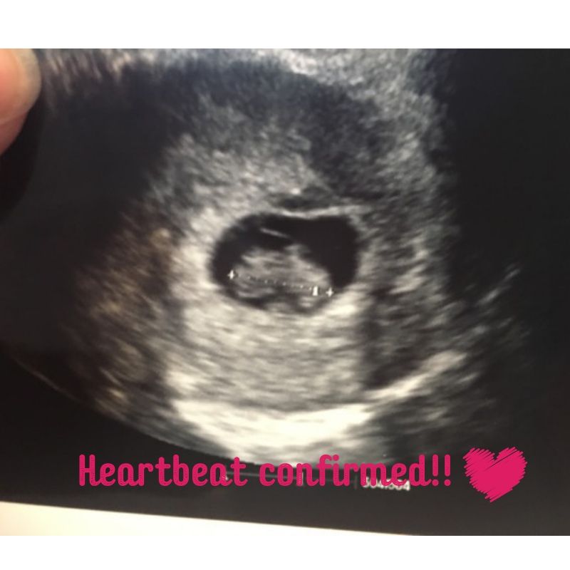 PacificSurro's tweet photo. Happy Monday! It's an exciting day today #IntendedParents and their super #Surrogate had a heartbeat confirmation today! ❤️❤️❤️❤️  
#7weekspregnant#pacificsurrogacy #IVFclinic #ExcitingNews #gestationalsurrogacy #Happymonday #familydream #mommytobe https://t.co/2BG0OHypN9