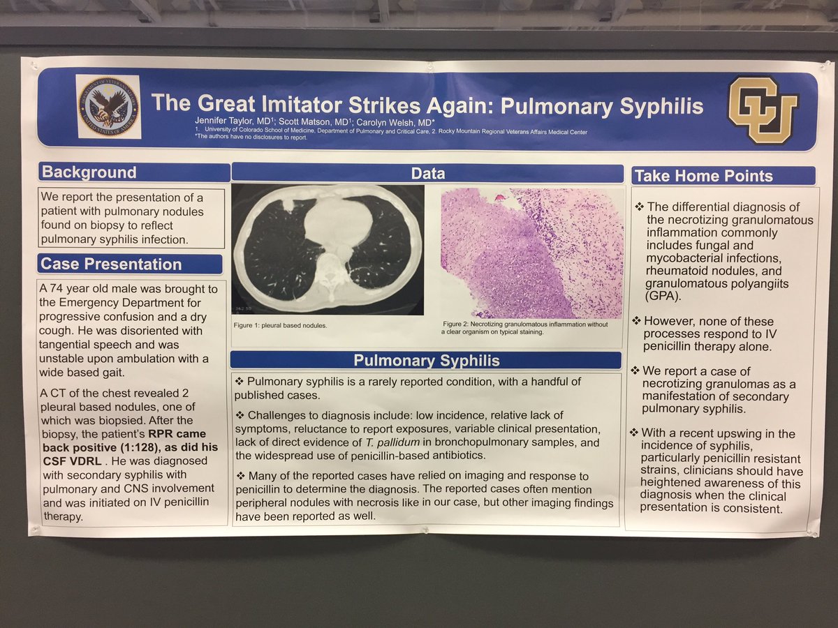 JasonMansoori's tweet photo. 1st year University of Colorado PSCCM fellow Dr. Jen Taylor’s excellent presentation of a fascinating case of Pulmonary Syphilis #ATS2019 https://t.co/2UGV9IKvCj