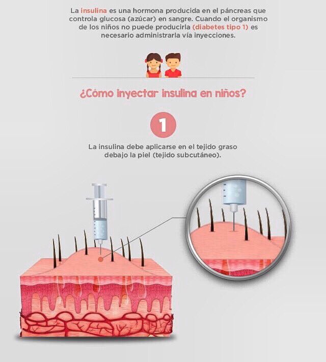 IDTADiabetes's tweet photo. Inyección de insulina en niños 👧🏻🧒🏻
.
#idta #idtadiabetes #diabetologia #endocrinologia #diabetes #diabetesmellitus #diabetes1 #diabetes2 #diabetesniños #diabetessalud #cuidados #medicina #diabetesgestacional https://t.co/VRn92sl32K
