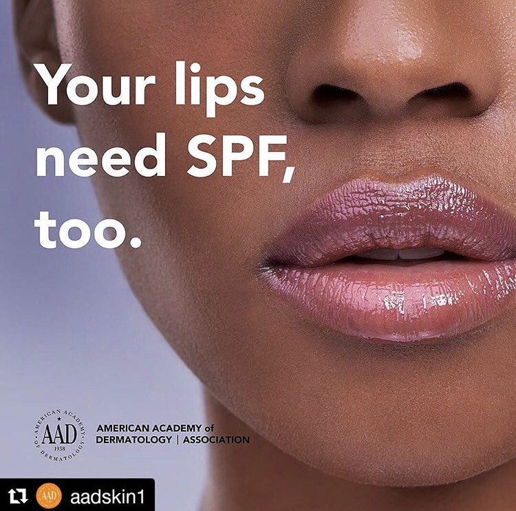 MariwallaDerm's tweet photo. Protect the Pucker! 💋💋
Skin cancer can develop anywhere on your body – even your lips! #PracticeSafeSun by using a lip balm with SPF 30+ and wearing a wide-brimmed hat for extra protection.
#PuckerUp #ProtectThePucker #MelanomaMay #SunProtection #PlaySafeInTheSun https://t.co/2smbbppw4u