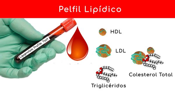 que significa colesterol hdl ldl vldl