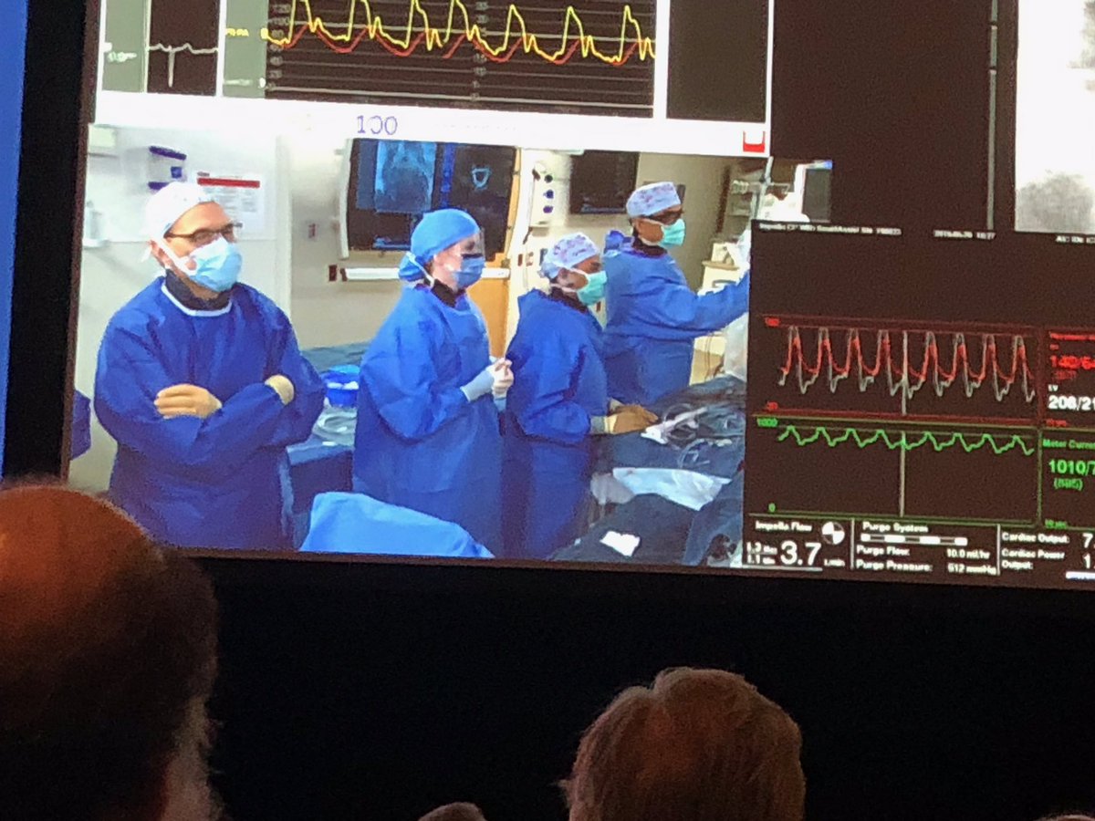 AlokSharma081's tweet image. Extremely grateful for such an amazing &amp;amp; distinguished group of moderators/panelists during live CHIP case w @RizikMd @Herms2James and @KopCardiologist. Thank you @ajaykirtane @DrCindyGrines @SCAI_Prez @drmortkern @nadia_sutton @JDawnAbbott1 @SVRaoMD #SCAI2019 #lifelonglearning