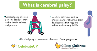 NeurosciScience's tweet photo. Cerebral palsy is a condition in which the ability to control muscles is reduced due to nervous system damage before, during or after birth. This nervous system damage affects body movement and posture. https://t.co/Ono1C50tR0 https://t.co/eC5IvcFhPX