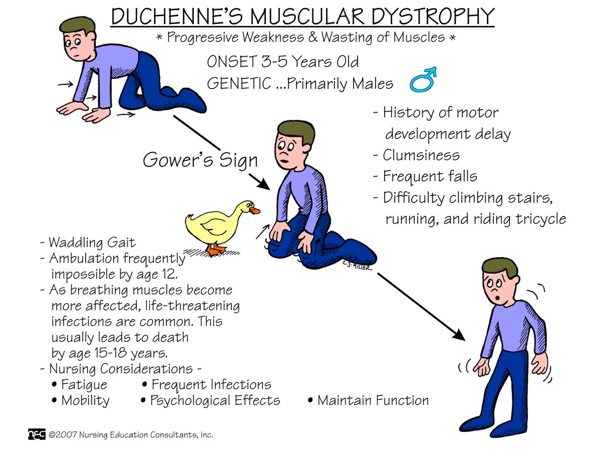 Muscular Dystrophy Symptoms