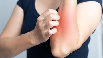 Checkpoint-Inhibitoren: Metaanalyse enthüllt die häufigsten Nebenwirkungen – und wie gefährlich sie sind <a href="/JAMAOnc/">JAMA Oncology</a> #Onko #Nebenwirkungen #Checkpoint
deutsch.medscape.com/artikelansicht…