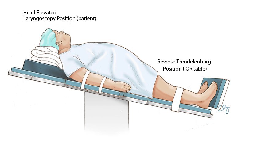 NaveenEipe's tweet image. Looks like a #MObesity #DifficultAirway setup?
The 7P's of #MODA, but #TheGreatest of these is #Position!
@AirwayMxAcademy