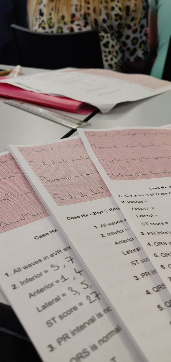 BU_ParaScience's tweet photo. ECGs, ECGs and more ECGs.. ECG workshop with a brilliantly designed workbook from our lecturer! Still surprises me how much you can learn from a single ECG.. #ecgworkshop #studentparamedic #buproud @hss_bu https://t.co/C1YPHIBWGK