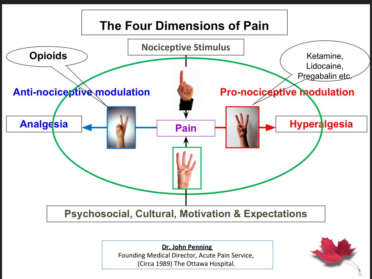 NaveenEipe's tweet photo. @colinjmccartney @doccigar @DavidJuurlink @brownpa79 @glbryson @euroanaesthesia @ESA_HQ @Drhaclarke @EMARIANOMD @cpaolag @amit_pawa Dr Penning calls this #Pronociception which presents as Hyperlgesia, the 3rd Dimension of Pain!
Opioids are not only ineffective, they can paradoxically make this kind of pain worse!
Finally, persistent Hyperalgesia May predict #CPSP? https://t.co/AUhAJ9Wv2E