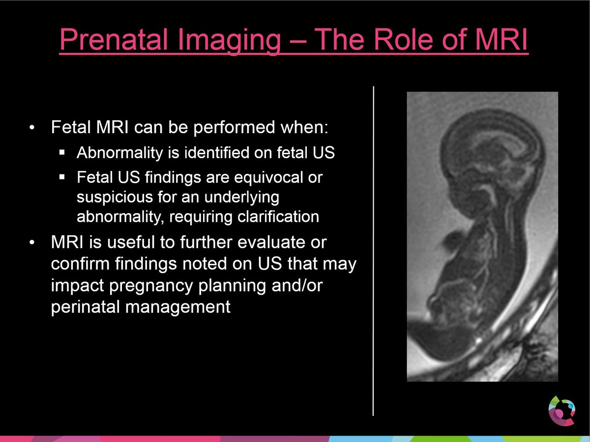 CincyKidsRad's tweet photo. Per @onofrj, fetal MRI is used when an abnormality is identified on prenatal ultrasound #ASNR19 https://t.co/2dzU1Mb2WH