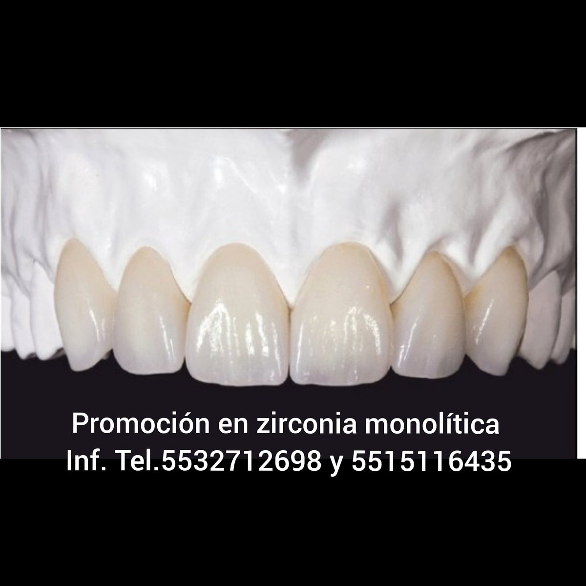 DentalTds's tweet photo. 15% de descuento en zirconia monolítica por unidad. Tel 553271-2698 https://t.co/hMmLuBNVOH