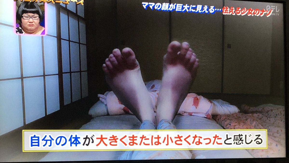 不思議の国のアリス症候群 がテレビで取り上げられ話題に Togetter 不思議の国のアリス症候群 がテレビで取り上げられ話題に Togetter
