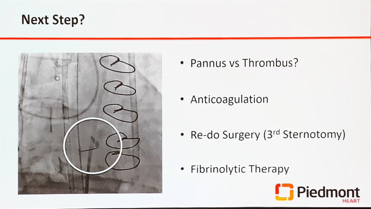 willsuh76's tweet photo. #SCAI2019 Cath Lab Boot Camp #HeartTeamApproach 
@KaulP on A Case of Shock and Awe - cardiac arrest patient placed on VA ECMO. Mechanical valve frozen leaflet. #HeartTeam decision to try something new. 1/n https://t.co/0PFJZ5F8wJ