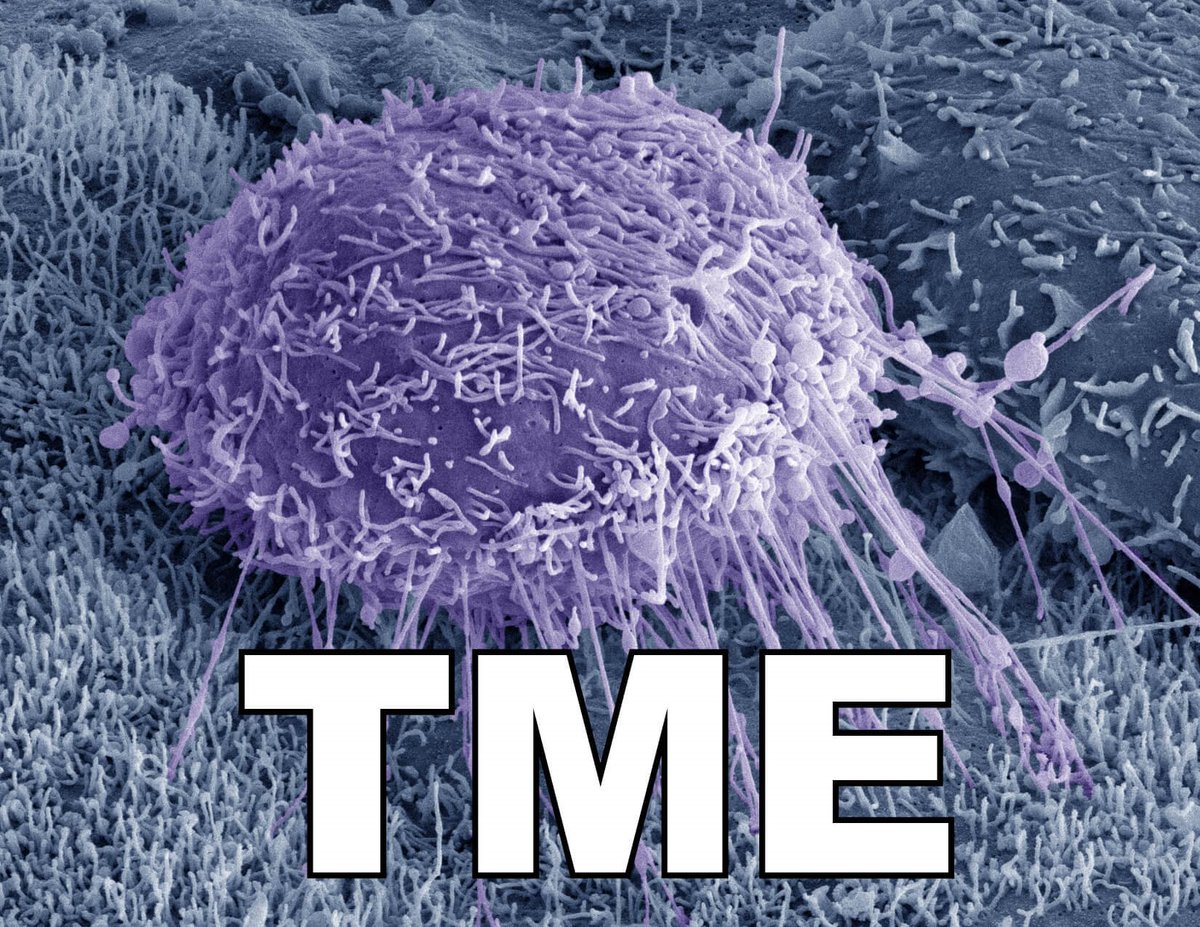 KU Otolaryngology - Head & Neck Surgery (@ku_ent) on Twitter photo Interested in tumor microenvironment research? Follow the convo via #MidwestTME & keep up on the latest research shared at the Annual Midwest Tumor Microenvironment Meeting hosted this year by Harper Cancer Institute <a href="/UNDResearch/">Notre Dame Research</a>
#cancer #tumor #ent #cancerbiology #research Interested in tumor microenvironment research? Follow the convo via #MidwestTME & keep up on the latest research shared at the Annual Midwest Tumor Microenvironment Meeting hosted this year by Harper Cancer Institute <a href="/UNDResearch/">Notre Dame Research</a>
#cancer #tumor #ent #cancerbiology #research