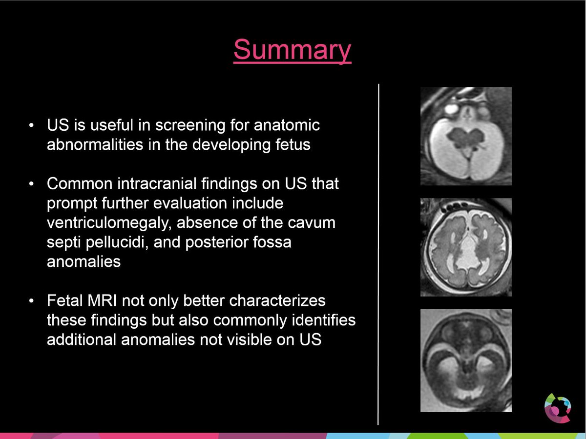 CincyKidsRad's tweet photo. Congratulations @onofrj. Your poster is a tour de force, must see at #ASNR19 https://t.co/S0mjUtKIop