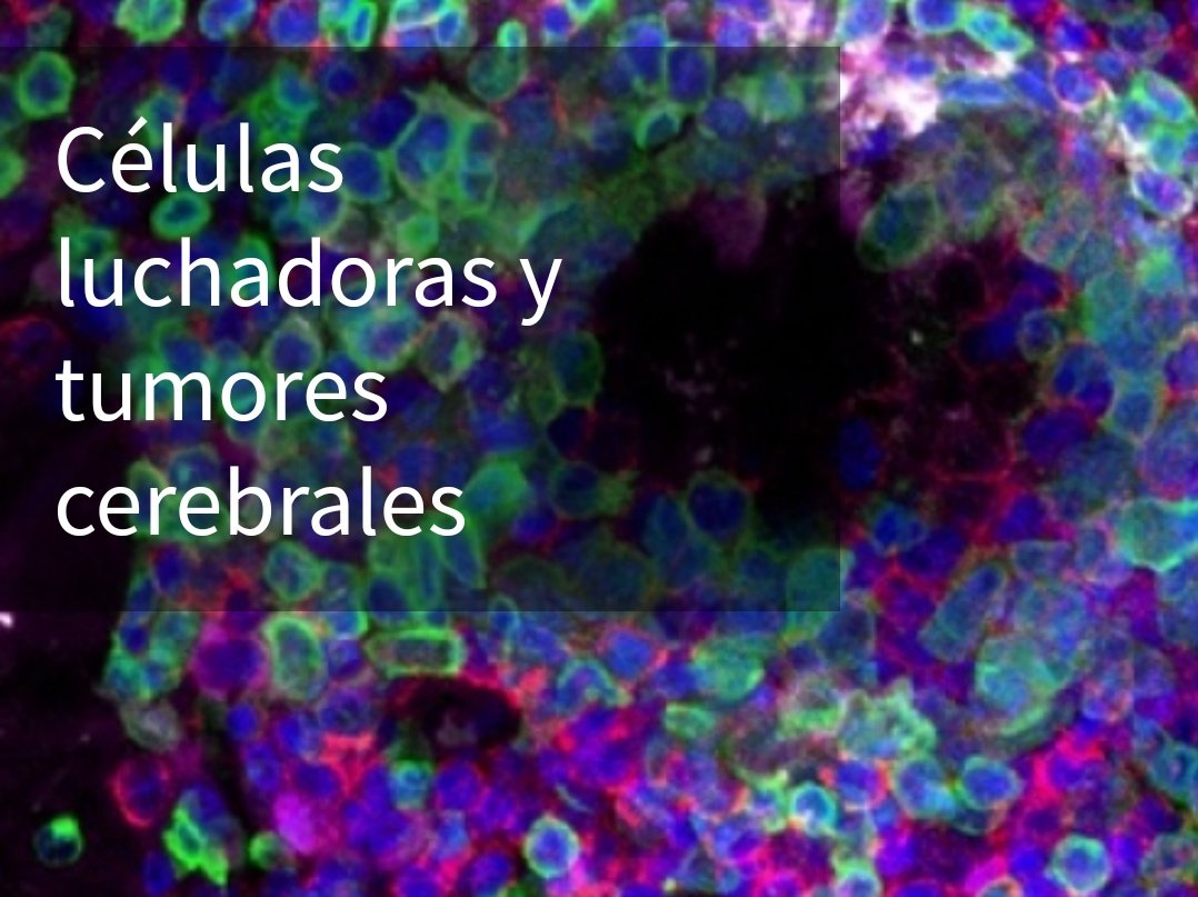 Si tuvieras un superzoom para ver la belleza y complejidad del tejido nervioso cómo te lo imaginarias? Hoy en #FIUHOUSE #LLOP viajamos a dentro del cerebro. No te lo pierdas!EMPEZAMOS A LAS 19:30!
#Pint19BCN #Pint19ES 
📍FIU HOUSE, C. Carme 42
🕐 19:30h, apertura de puertas 19h!